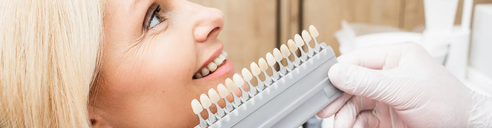 Porcelain Veneers