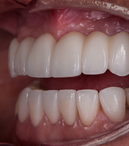 Patient's smile before a dental treatment