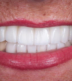 A bright smile after a dental treatment