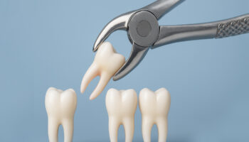 What to Expect with Tooth Extraction?