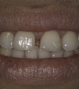 Comfortable waiting area - Bay Premier Dentistry