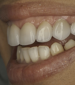 Bay Premier Dentistry