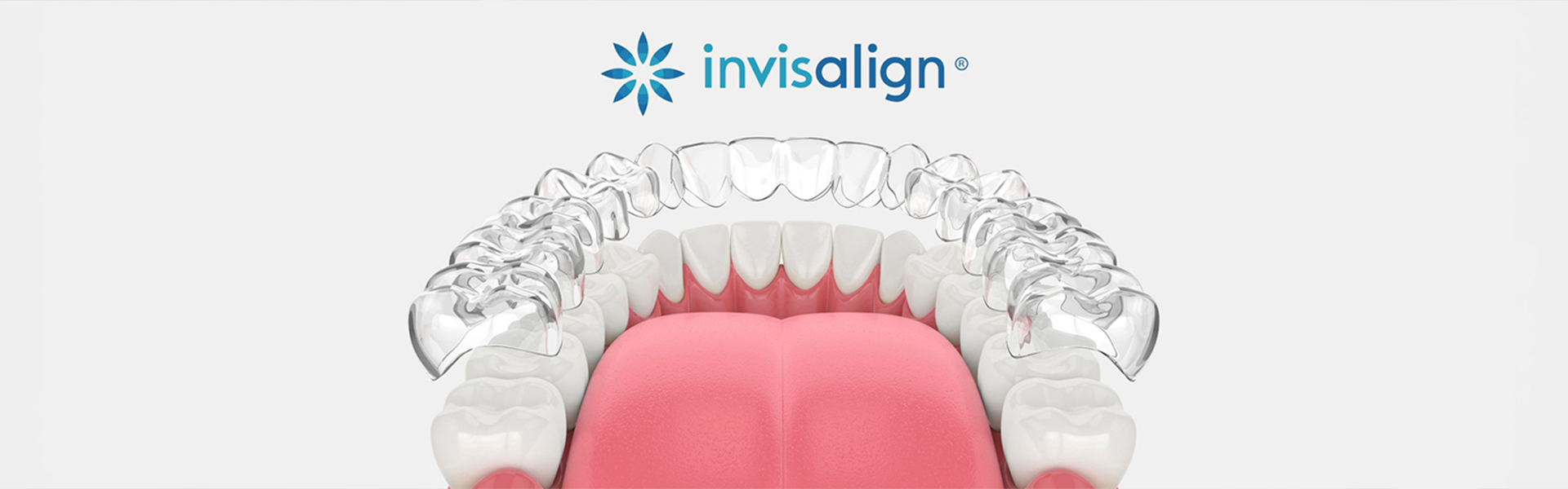 Types of Dental Problems Invisalign Can Correct