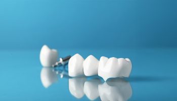 Are Dental Crowns Painful? What You Need to Know Before Treatment